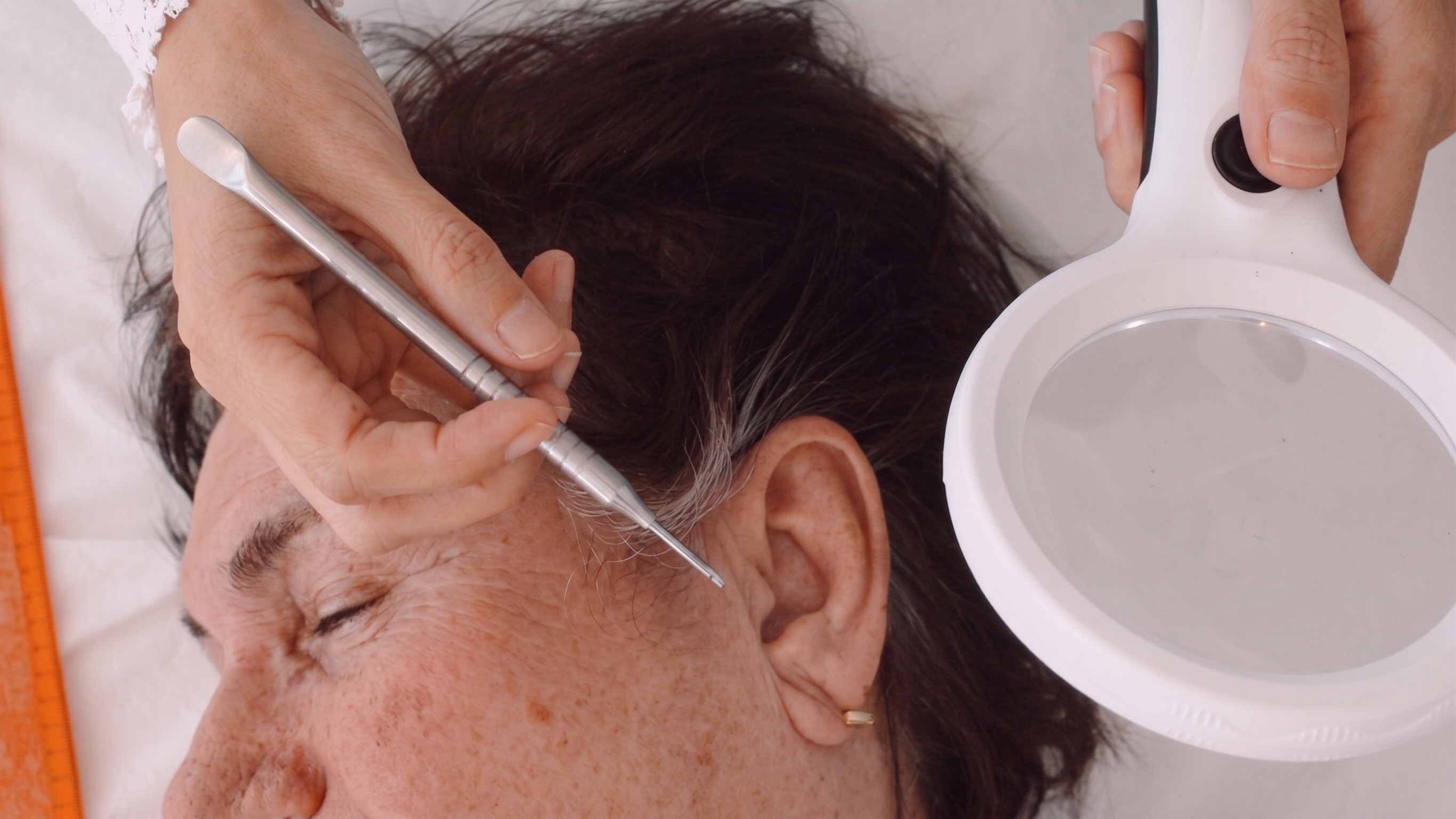 Fisioterapeuta da Fisiome realiza atendimento domiciliar em Boa Viagem, Recife, aplicando delicadamente sementes de auriculoterapia no pavilhão auricular de uma paciente confortavelmente sentada na sala de sua casa, promovendo alívio da dor e relaxamento.